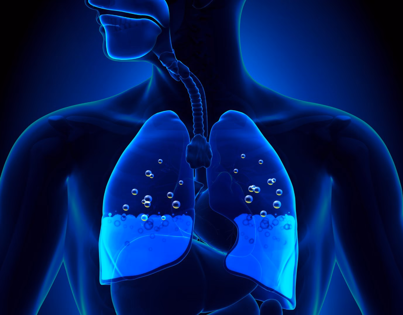 Jaki jest powód zbierania się wody w płucach?