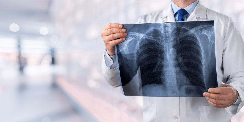 Czy palenie powoduje wodę w płucach?