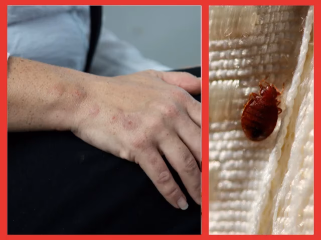 Czy pluskwy przejdą z pokoju do pokoju?