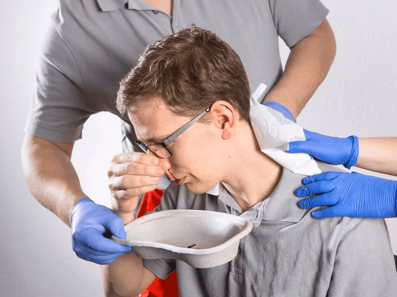 Co wywołuje krwotok z nosa?