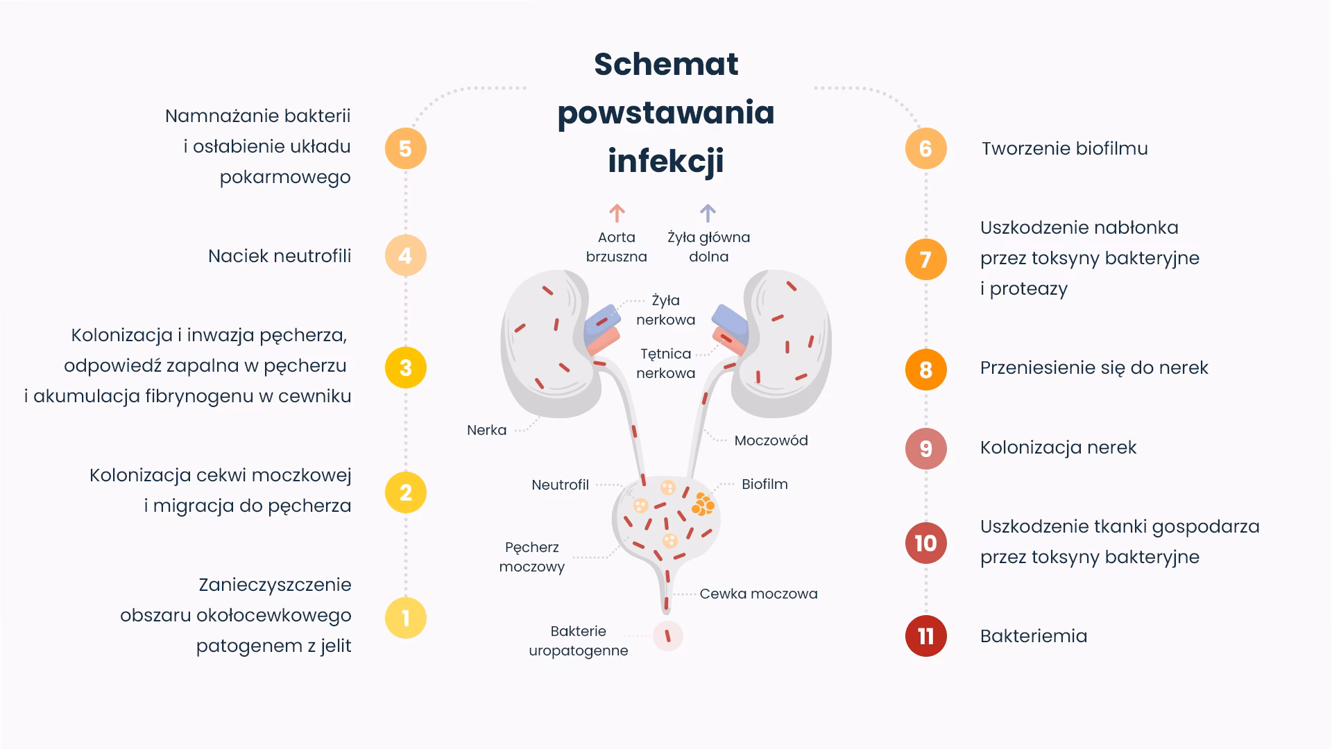 Czy zapalenie pęcherza może być spowodowane klimatyzacją?