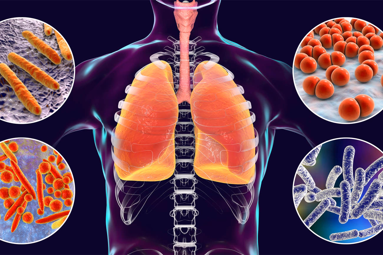 Czy w klimatyzacji są bakterie?
