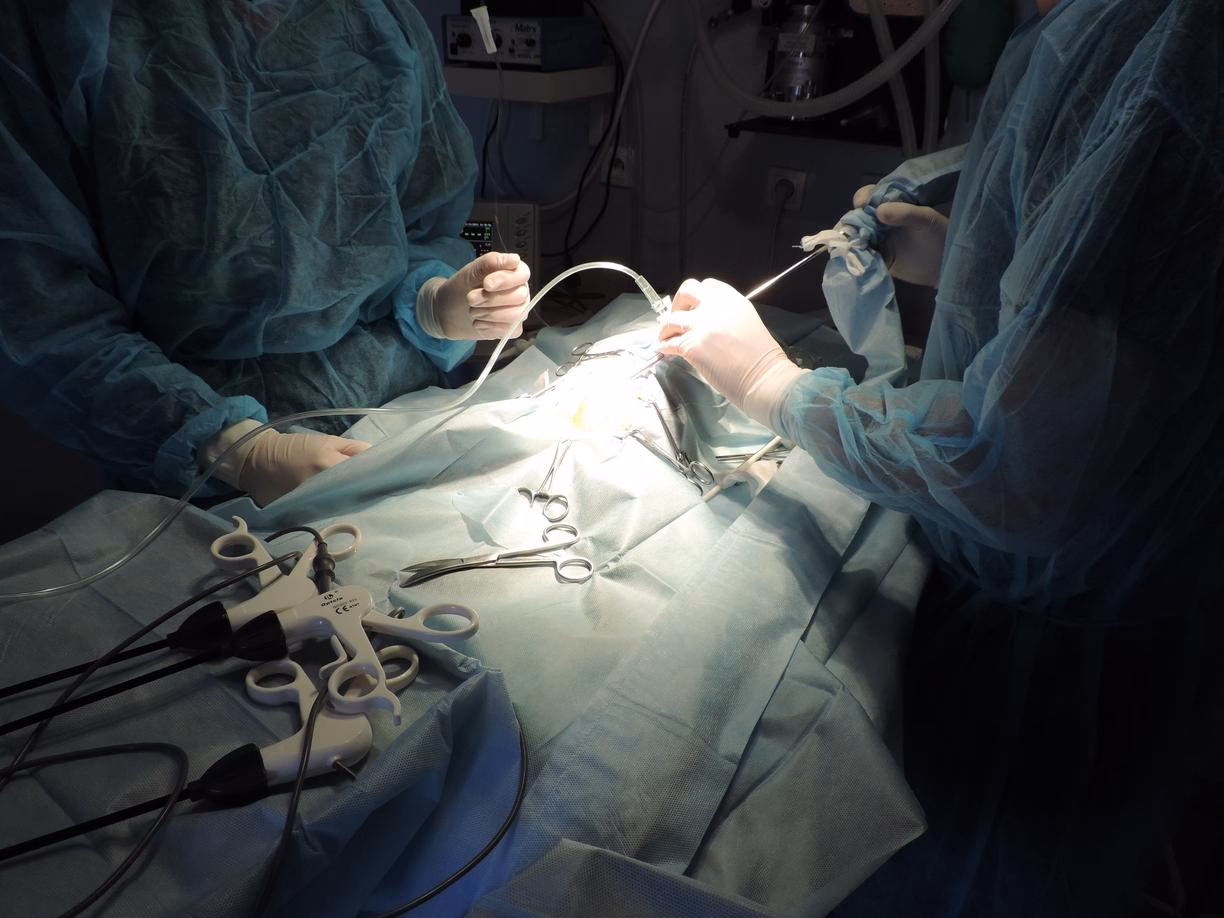 Jakie mogą być powikłania po laparoskopii?