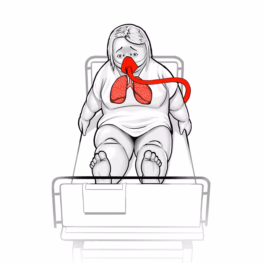 Jaka pozycja przy obrzęku płuc?