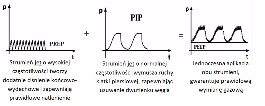 Co to jest pip w respiratorze?