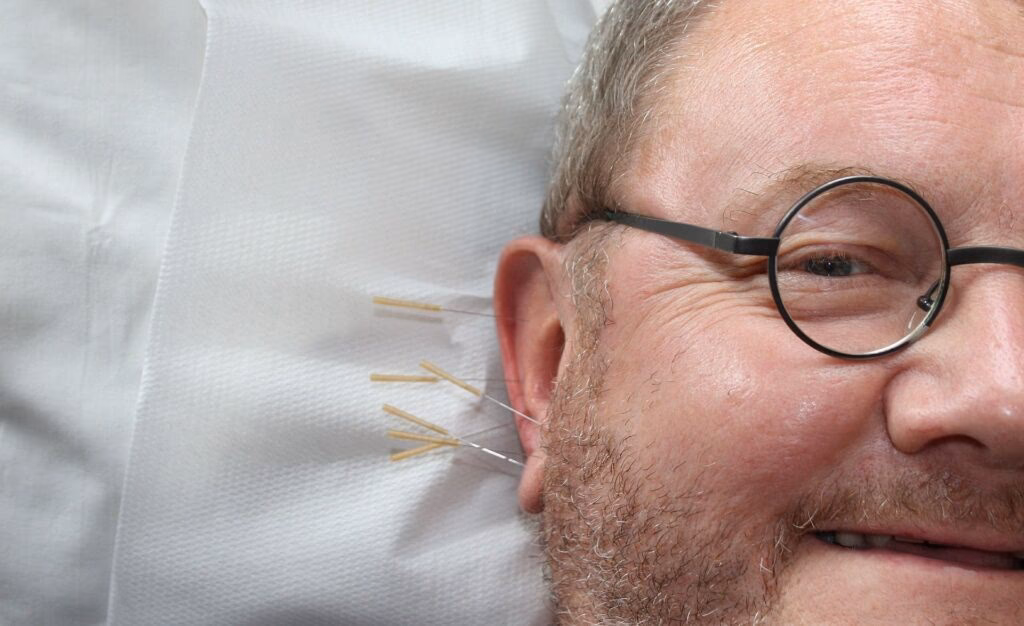 Czy zimny kompres jest dobry na porażenie Bella?