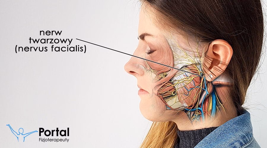 Czego unikać przy porażeniu nerwu twarzowego?