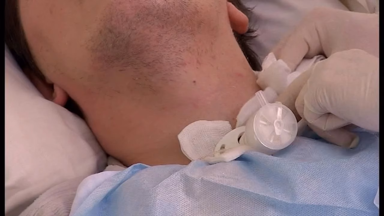 Czy z rurka tracheostomijna można normalnie funkcjonować?