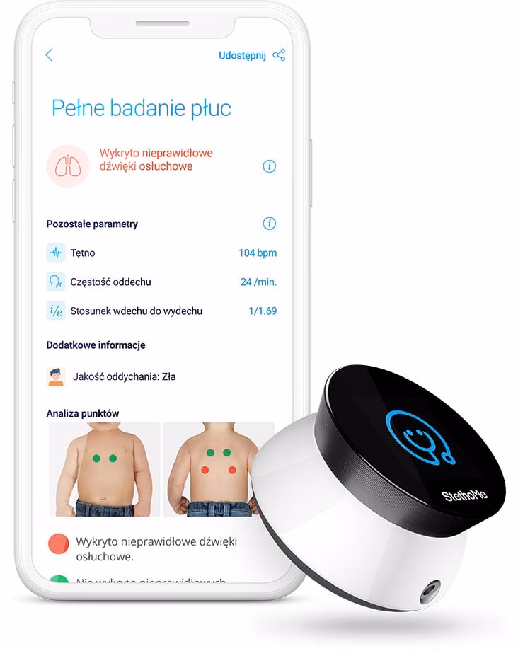 Czy szmer pęcherzykowy powinien być symetryczny?