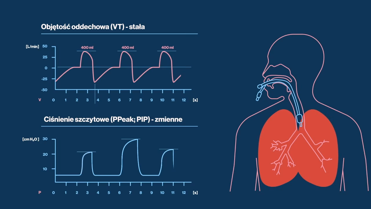 Kiedy stosuje się wentylację inwazyjną?